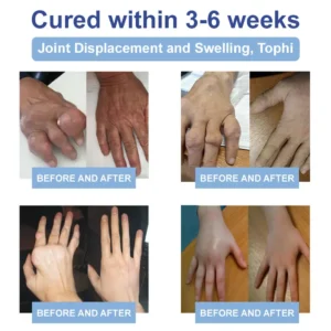 ✅𝐎𝐟𝐟𝐢𝐜𝐢𝐚𝐥 𝐒𝐭𝐨𝐫𝐞:  𝐎𝐮𝐫𝐥𝐲𝐚𝐫𝐝® 𝐌𝐚𝐠𝐧𝐞𝐬𝐢𝐮𝐦 𝐏𝐚𝐢𝐧 𝐇𝐞𝐚𝐥𝐢𝐧𝐠 𝐁𝐨𝐧𝐞 𝐂𝐫𝐞𝐚𝐦 (Effective relief for arthritis, nerve pain, rheumatic conditions, muscle spasms, and sports injuries)