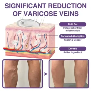 𝐎𝐮𝐫𝐥𝐲𝐚𝐫𝐝® 𝐅𝐞𝐞𝐋𝐞𝐠 𝐂𝐚𝐫𝐞 𝐏𝐡𝐲𝐭𝐨 𝐆𝐞𝐥