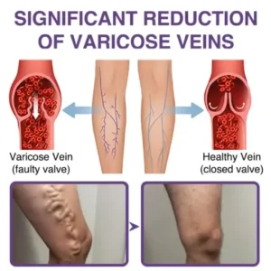 𝐎𝐮𝐫𝐥𝐲𝐚𝐫𝐝® 𝐅𝐞𝐞𝐋𝐞𝐠 𝐂𝐚𝐫𝐞 𝐏𝐡𝐲𝐭𝐨 𝐆𝐞𝐥