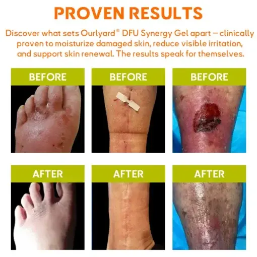 ๐๐ฎ๐ซ๐ฅ๐ฒ๐๐ซ๐ยฎ ๐๐
๐ ๐๐ฒ๐ง๐๐ซ๐ ๐ฒ ๐๐๐ฅ