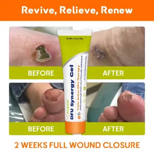 ๐๐ฎ๐ซ๐ฅ๐ฒ๐๐ซ๐ยฎ ๐๐
๐ ๐๐ฒ๐ง๐๐ซ๐ ๐ฒ ๐๐๐ฅ