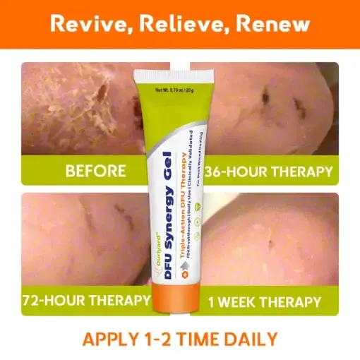 ๐๐ฎ๐ซ๐ฅ๐ฒ๐๐ซ๐ยฎ ๐๐
๐ ๐๐ฒ๐ง๐๐ซ๐ ๐ฒ ๐๐๐ฅ