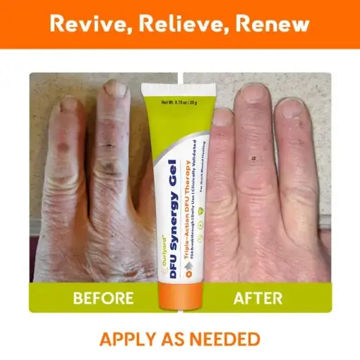 ๐๐ฎ๐ซ๐ฅ๐ฒ๐๐ซ๐ยฎ ๐๐
๐ ๐๐ฒ๐ง๐๐ซ๐ ๐ฒ ๐๐๐ฅ