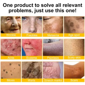 🫶🫶FDA Approved: Ourlyard® Bee venom Pro Comprehensive Cream — 🔥Limited Time 80% OFF🔥