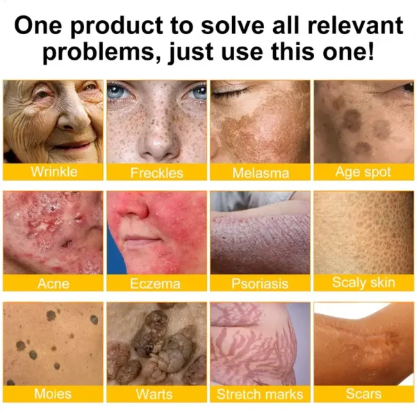 🫶🫶FDA Approved: Ourlyard® Bee venom Pro Comprehensive Cream — 🔥Limited Time 80% OFF🔥