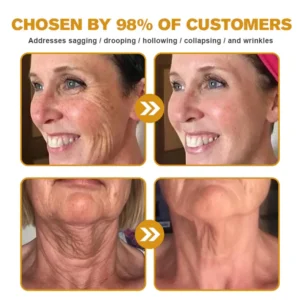 🫶🫶FDA Approved: Ourlyard® Bee venom Pro Comprehensive Cream — 🔥Limited Time 80% OFF🔥