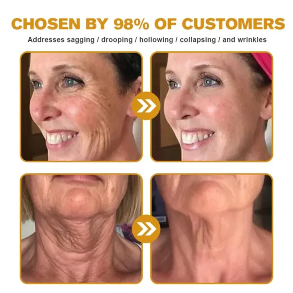 🫶🫶FDA Approved: Ourlyard® Bee venom Pro Comprehensive Cream — 🔥Limited Time 80% OFF🔥
