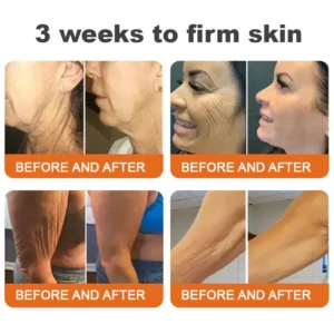 🫶🫶FDA Approved: Ourlyard® Bee venom Pro Comprehensive Cream — 🔥Limited Time 80% OFF🔥