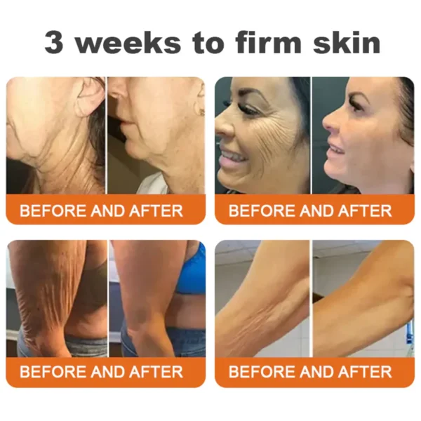 🫶🫶FDA Approved: Ourlyard® Bee venom Pro Comprehensive Cream — 🔥Limited Time 80% OFF🔥