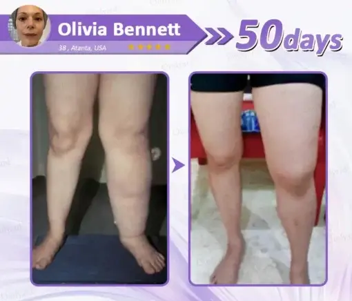 Ourlyard® GLP-1 Slimming & Glucose-Control Ultra-Concentrated Wellness Essence Beads