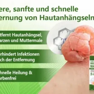 Ourlyard® Magnesium MicroNeedle Schnell Entfernen Hautmal-Pflaster