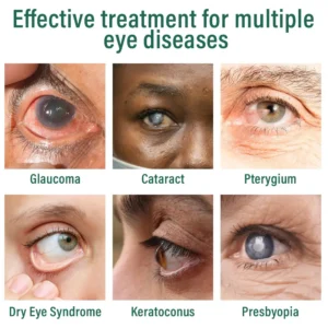 👩‍⚕️Ourlyard® Nano Eye Drops Serum ✅FDA Approved(Suitable for presbyopia, dry eye syndrome, glaucoma, and cataracts) 🌻