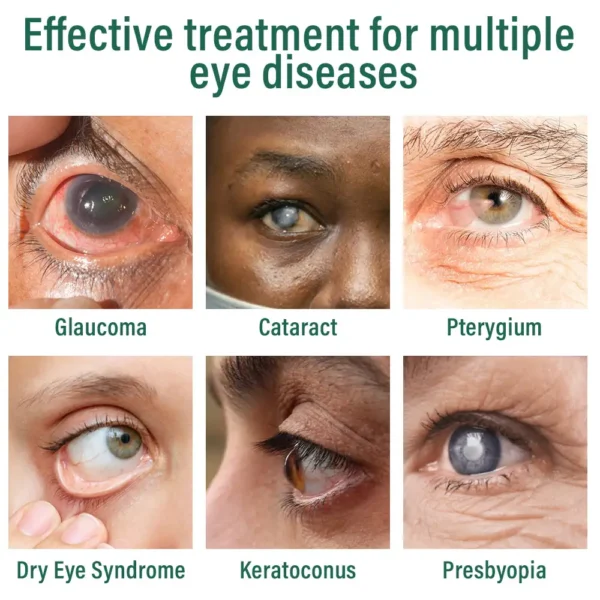 👩‍⚕️Ourlyard® Nano Eye Drops Serum ✅FDA Approved(Suitable for presbyopia, dry eye syndrome, glaucoma, and cataracts) 🌻