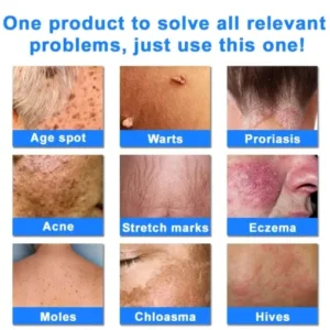 Ourlyard® Skin Treatment Cream