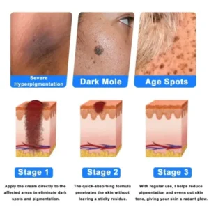 Ourlyard® Skin Treatment Cream