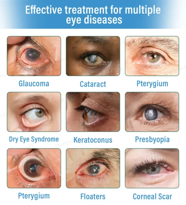 👩‍⚕️Ourlyard® Supramolecular Eye Drops ✅FDA Approved (Suitable for cataracts, floaters, AMD, dry eye and presbyopia)