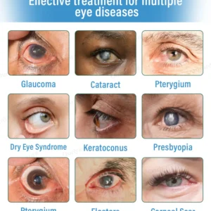 👩‍⚕️Ourlyard® Supramolecular Eye Drops ✅FDA Approved (Suitable for presbyopia, floaters, AMD and cataracts) 👀