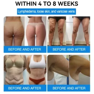 Ourlyardf® NAD+ GLP-1 Nano Microneedle Patch with Collagen & Matrixyl 3000