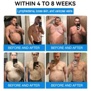 Ourlyardf® NAD+ GLP-1 Nano Microneedle Patch with Collagen & Matrixyl 3000