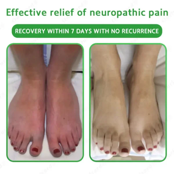 ✅FDA Approved|Ourlyard® Advanced Magnesium & Emu Oil Massage Pain Relief Cream (🏅The Ultimate Solution for Muscle Aches, Arthritis, Joint Pain, Nerve Pain, Inflammation, and Stiffness)