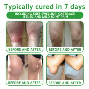 ✅FDA Approved|Ourlyard® Advanced Magnesium & Emu Oil Massage Pain Relief Cream (🏅The Ultimate Solution for Muscle Aches, Arthritis, Joint Pain, Nerve Pain, Inflammation, and Stiffness)