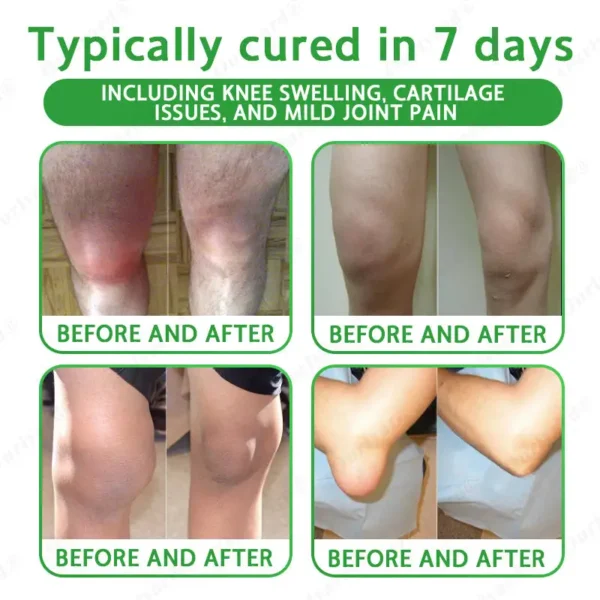 ✅FDA Approved|Ourlyard® Advanced Magnesium & Emu Oil Massage Pain Relief Cream (🏅The Ultimate Solution for Muscle Aches, Arthritis, Joint Pain, Nerve Pain, Inflammation, and Stiffness)