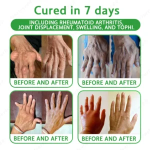✅FDA Approved|Ourlyard® Advanced Magnesium & Emu Oil Massage Pain Relief Cream (🏅The Ultimate Solution for Muscle Aches, Arthritis, Joint Pain, Nerve Pain, Inflammation, and Stiffness)