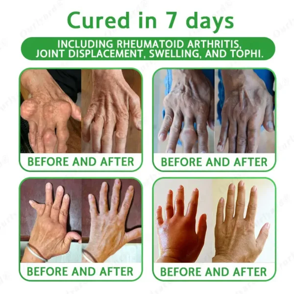✅FDA Approved|Ourlyard® Advanced Magnesium & Emu Oil Massage Pain Relief Cream (🏅The Ultimate Solution for Muscle Aches, Arthritis, Joint Pain, Nerve Pain, Inflammation, and Stiffness)