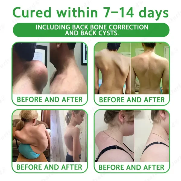 ✅FDA Approved|Ourlyard® Advanced Magnesium & Emu Oil Massage Pain Relief Cream (🏅The Ultimate Solution for Muscle Aches, Arthritis, Joint Pain, Nerve Pain, Inflammation, and Stiffness)