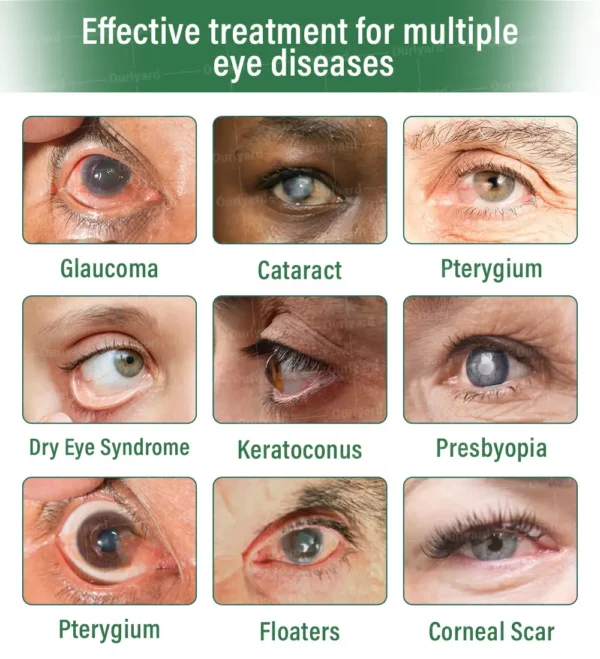👨🏻‍⚕️Ourlyard® ClariTech Nano Eye Drops ✅️ FDA Approved | Supports Presbyopia, Dry Eyes, Glaucoma & Cataracts🍀