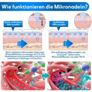 𝐎𝐮𝐫𝐥𝐲𝐚𝐫𝐝® 𝐓𝐢𝐫𝐳𝐞𝐩𝐚𝐭𝐢𝐝-𝐍𝐚𝐧𝐨𝐩𝐟𝐥𝐚𝐬𝐭𝐞𝐫