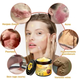 🔥FDA Approved: Ourlyard® Bee Venom Skin Restoration Cream — 🔥Limited Time 80% OFF🔥