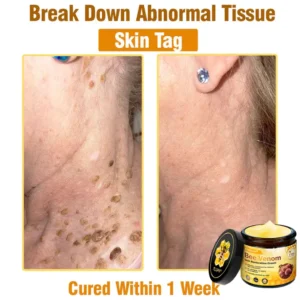 🔥FDA Approved: Ourlyard® Bee Venom Skin Restoration Cream — 🔥Limited Time 80% OFF🔥