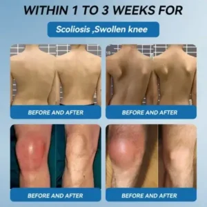 Ourlyard”® 𝐁𝐏𝐂-𝟏𝟓𝟕 𝐉𝐨𝐢𝐧𝐭 𝐇𝐞𝐚𝐥𝐢𝐧𝐠 Capsules