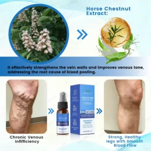✨Ourlyard® VascuCare Vein Healing Spray(Designed for Varicose veins, Spider veins, Deep vein Thrombosis, Chronic venous insufficiency, Venous ulcers, Thrombophlebitis and other venous issues)