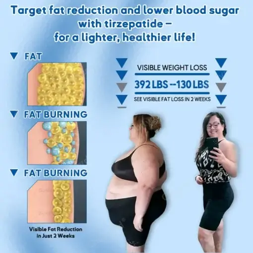 ๐๐ฎ๐ซ๐ฅ๐ฒ๐๐ซ๐ยฎ ๐๐ข๐ซ๐ณ๐๐ฉ๐๐ญ๐ข๐๐ ๐๐๐ง๐จ ๐๐๐ญ๐๐ก