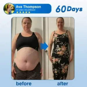 ๐๐ฎ๐ซ๐ฅ๐ฒ๐๐ซ๐ยฎ ๐๐ข๐ซ๐ณ๐๐ฉ๐๐ญ๐ข๐๐ ๐๐๐ง๐จ ๐๐๐ญ๐๐ก