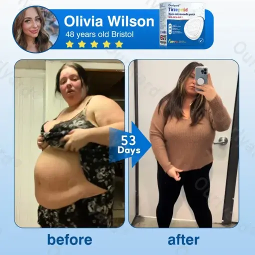 ๐๐ฎ๐ซ๐ฅ๐ฒ๐๐ซ๐ยฎ ๐๐ข๐ซ๐ณ๐๐ฉ๐๐ญ๐ข๐๐ ๐๐๐ง๐จ ๐๐๐ญ๐๐ก